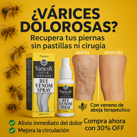 VaricoX Pro - Piernas libres de várices en 30 días garantizados 🎯💥