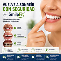 SmileFit™ CARILLAS DENTALES REMOVIBLES