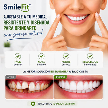 SmileFit™ CARILLAS DENTALES REMOVIBLES