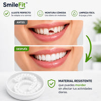 SmileFit™ CARILLAS DENTALES REMOVIBLES