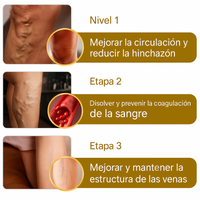VaricoX Pro - Piernas libres de várices en 30 días garantizados 🎯💥